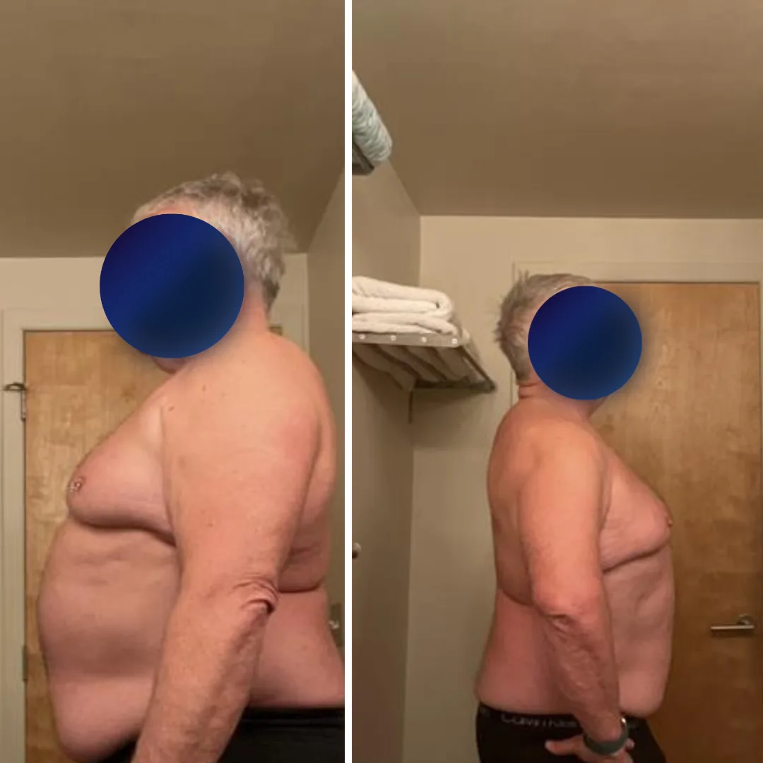 Brian's before and after